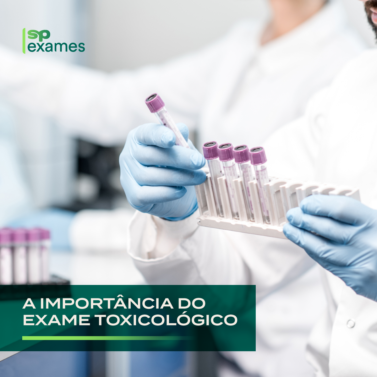 A importância do exame toxicológico | SP Exames